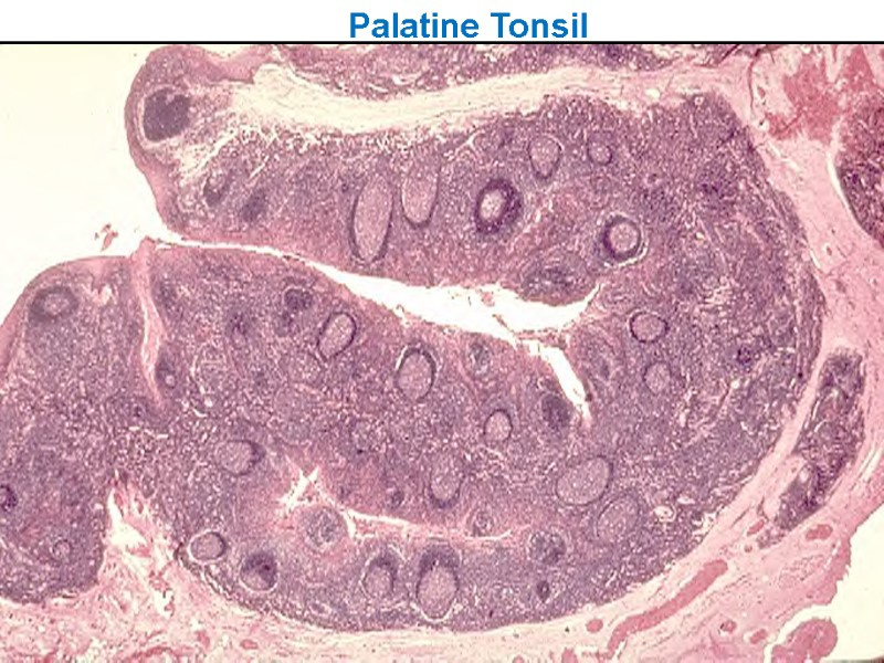 Palatine Tonsil